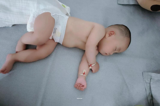 苏州宝宝上火有眼屎